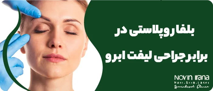 هزینه جراحی پلک در مشهد